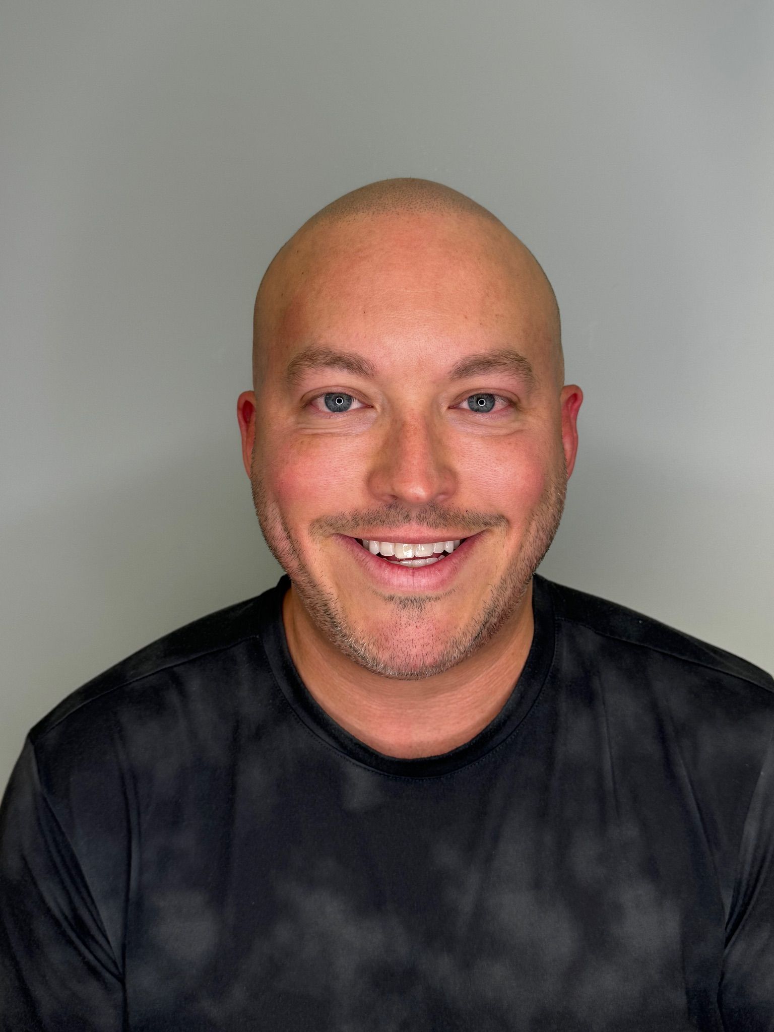 A bald man with a beard is smiling for the camera while wearing a black tie dye shirt.