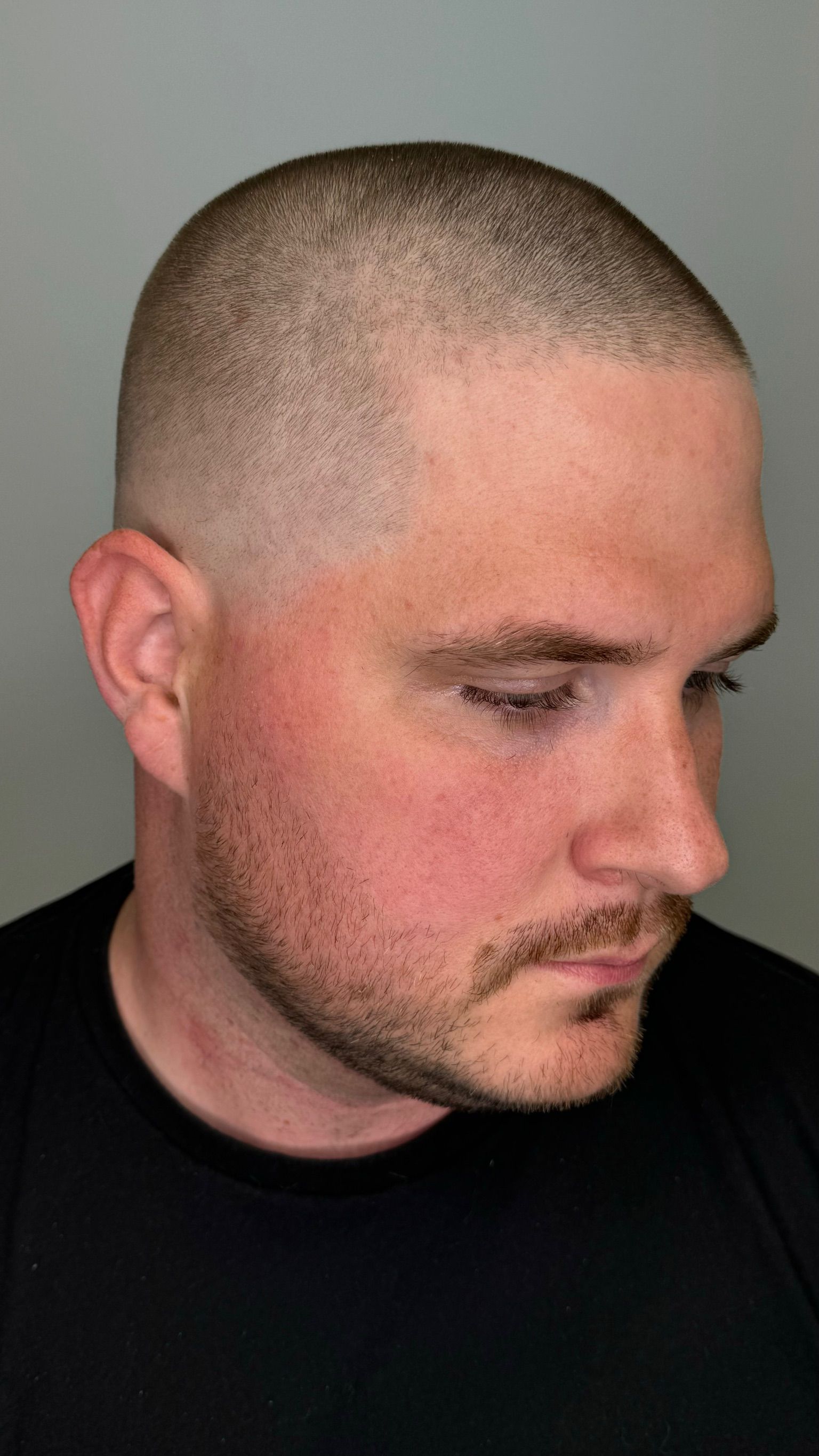 A man with a shaved head and a beard is wearing a black shirt.