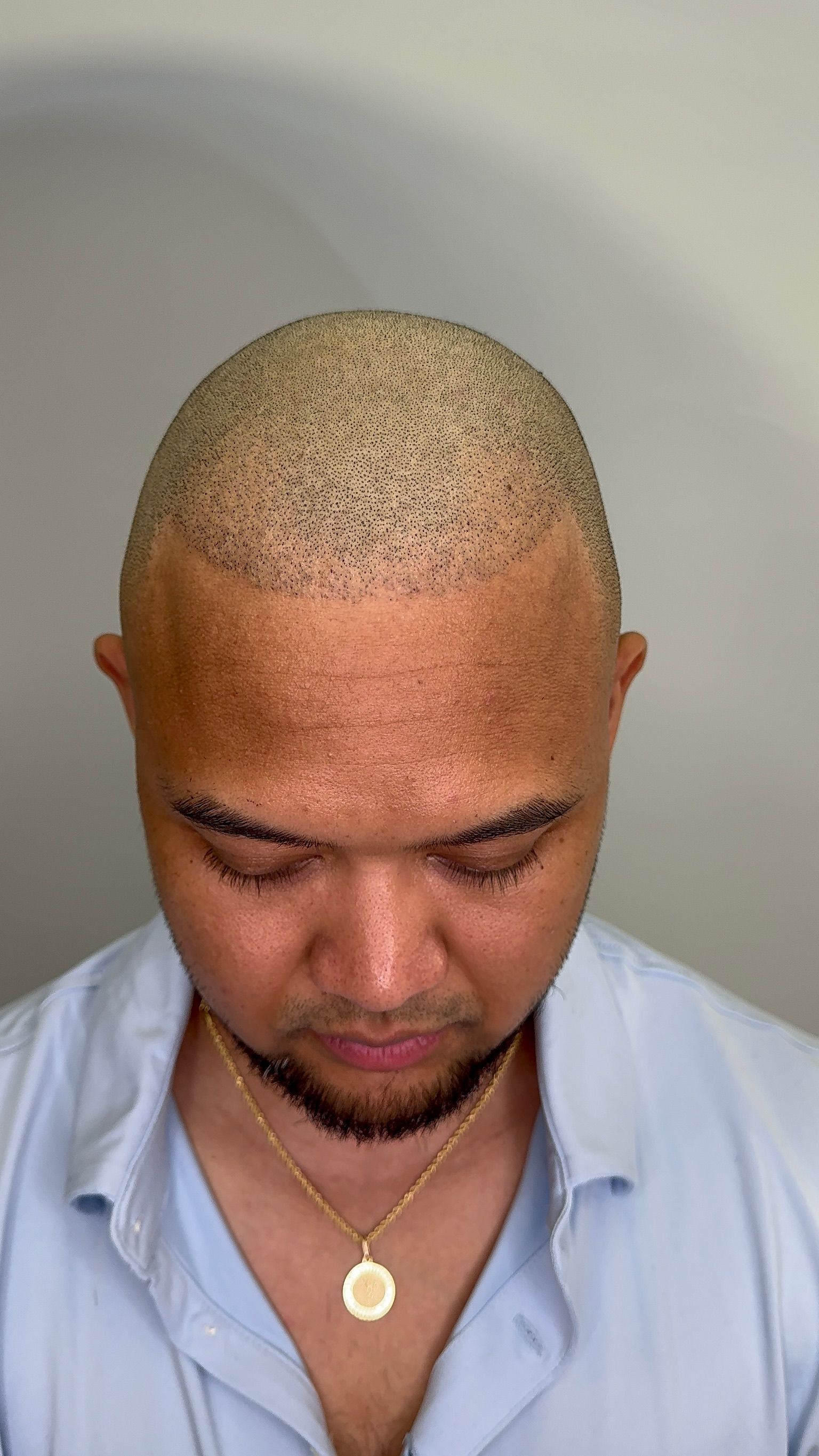 A man with a beard and a bald head is wearing a necklace.