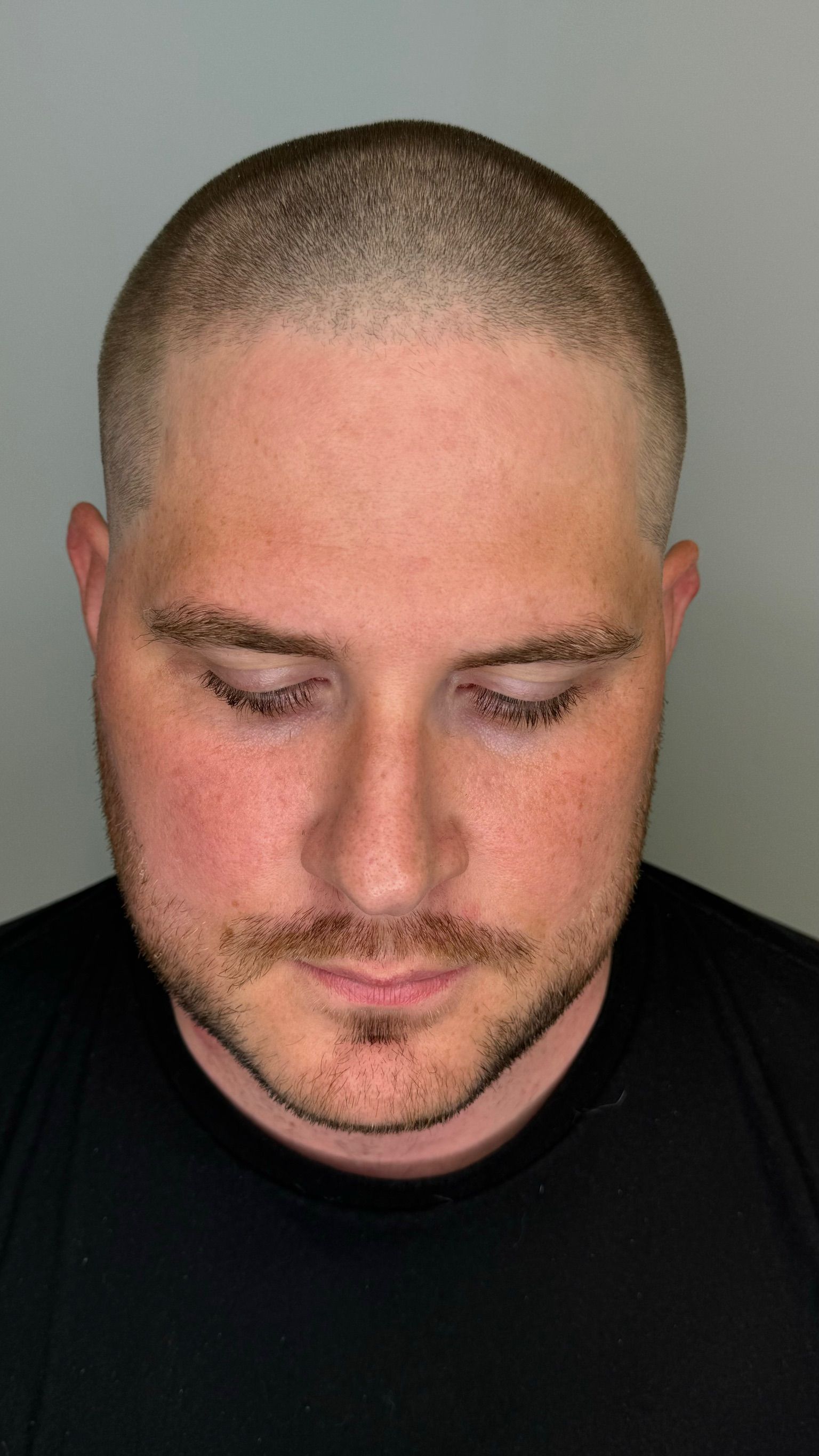 A man with a shaved head and a beard is wearing a black shirt.