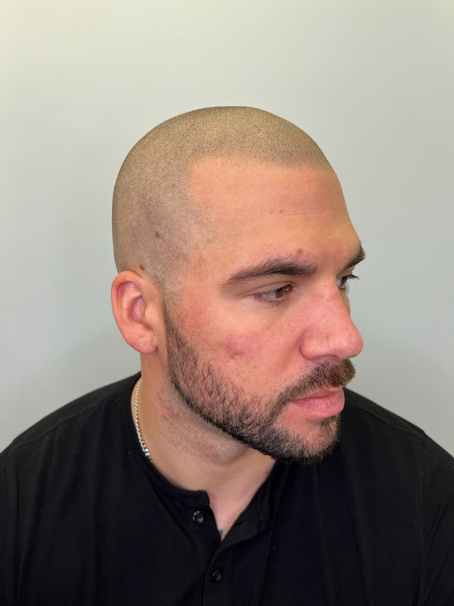 A man with a shaved head and beard is wearing a black shirt.