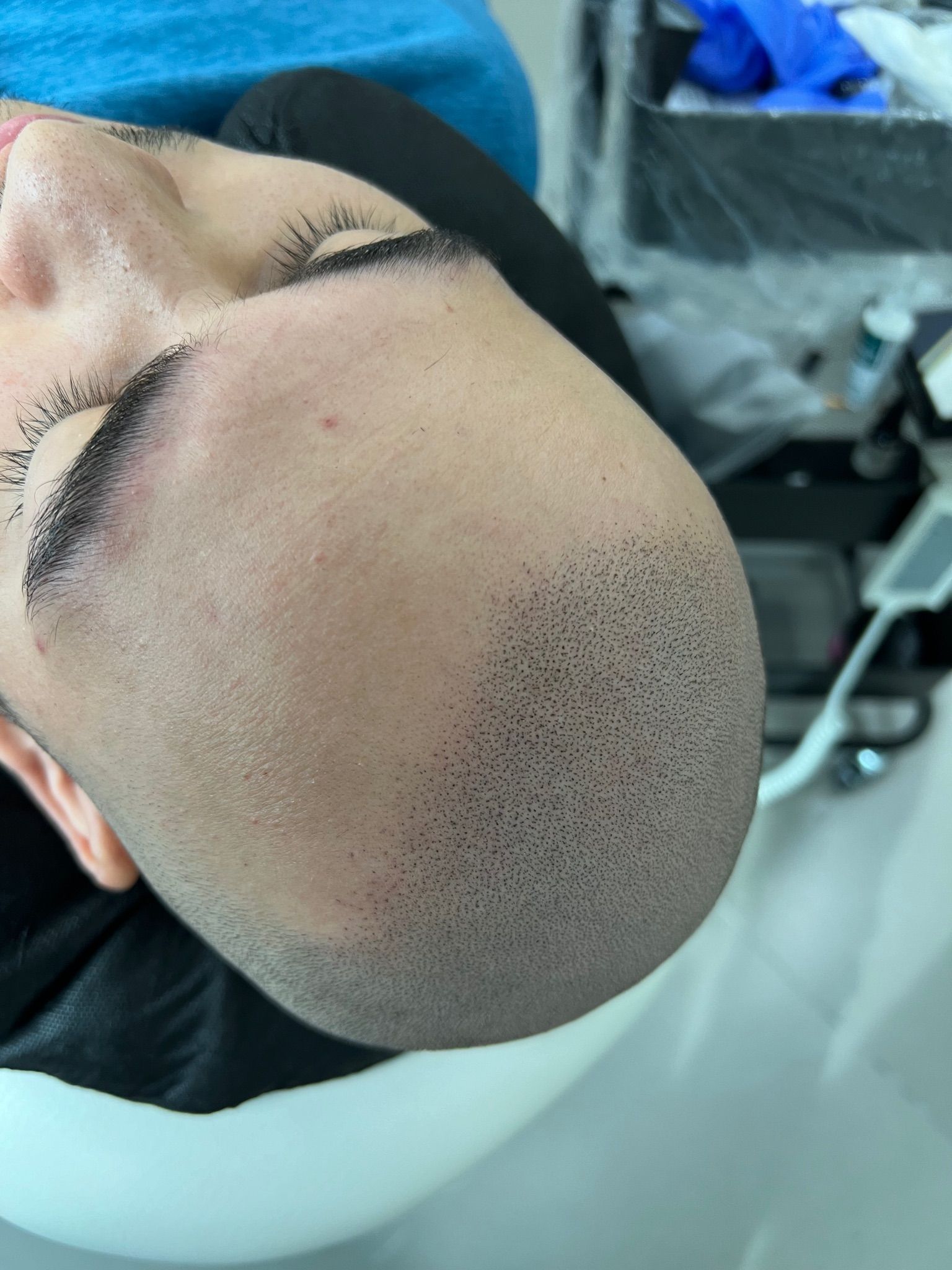 A man with a shaved head is laying down with his eyes closed