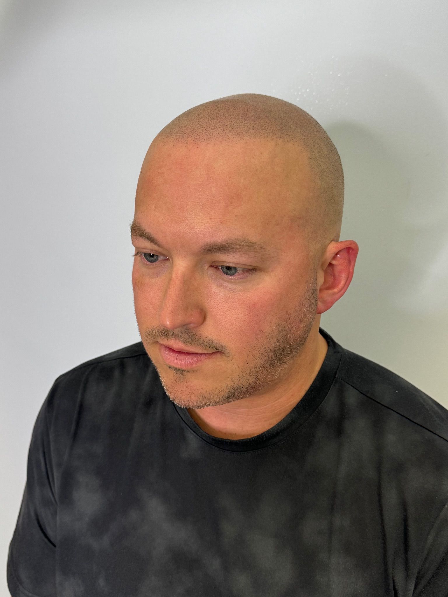 A bald man with a beard is wearing a black tie dye shirt.