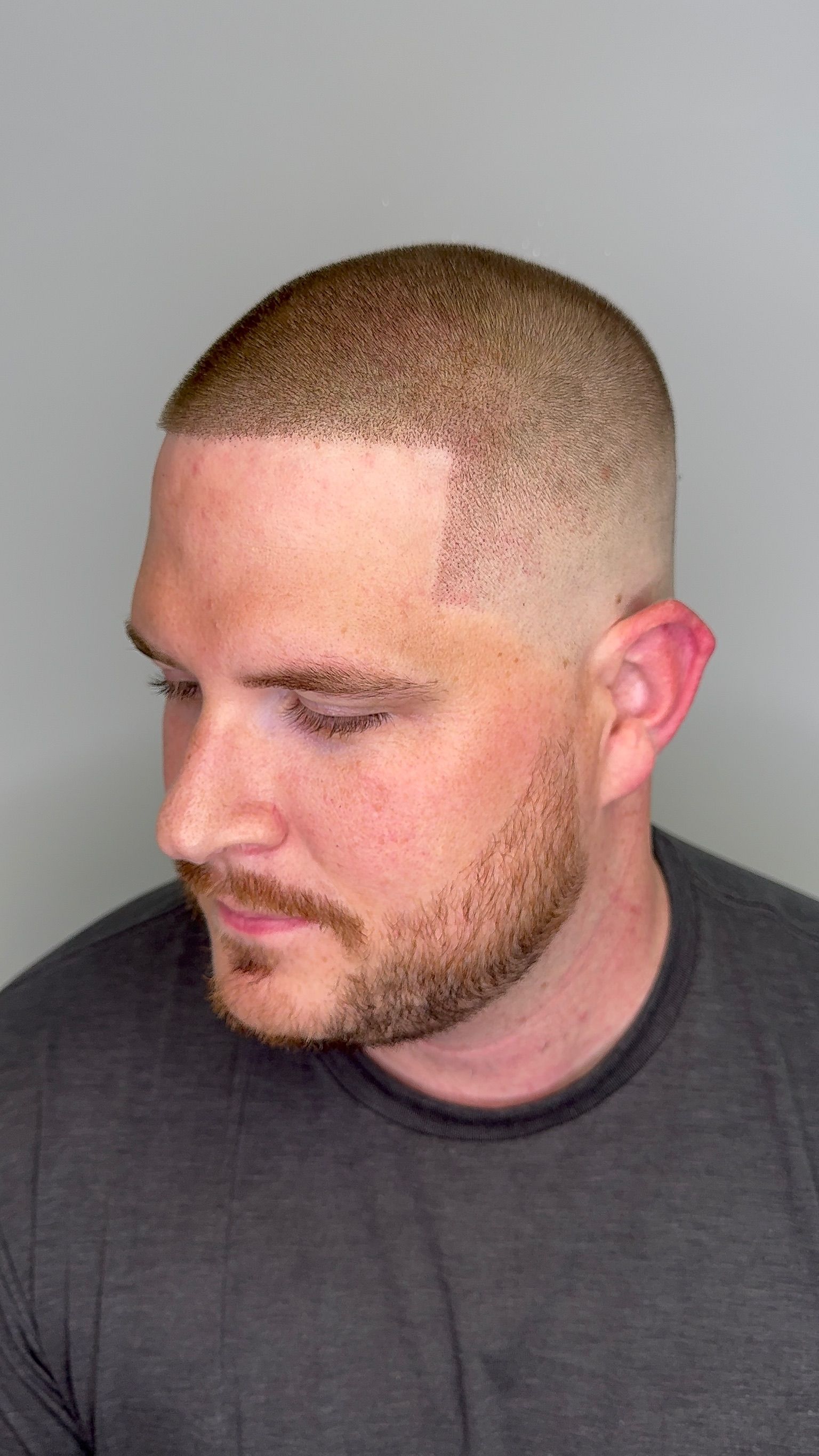 A man with a beard and a very short haircut is wearing a grey shirt.