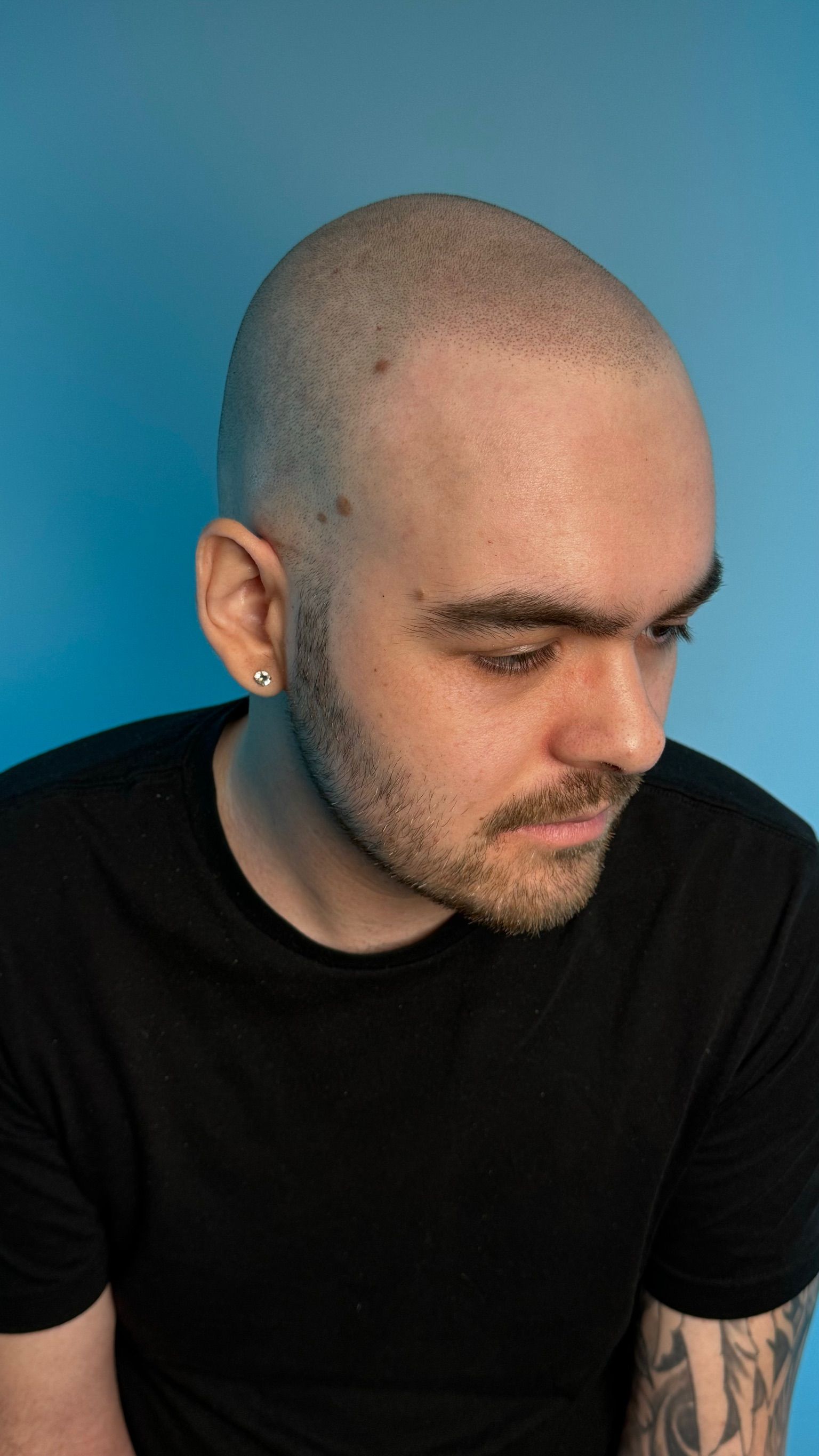 A man with a shaved head and a tattoo on his arm is wearing a black shirt.
