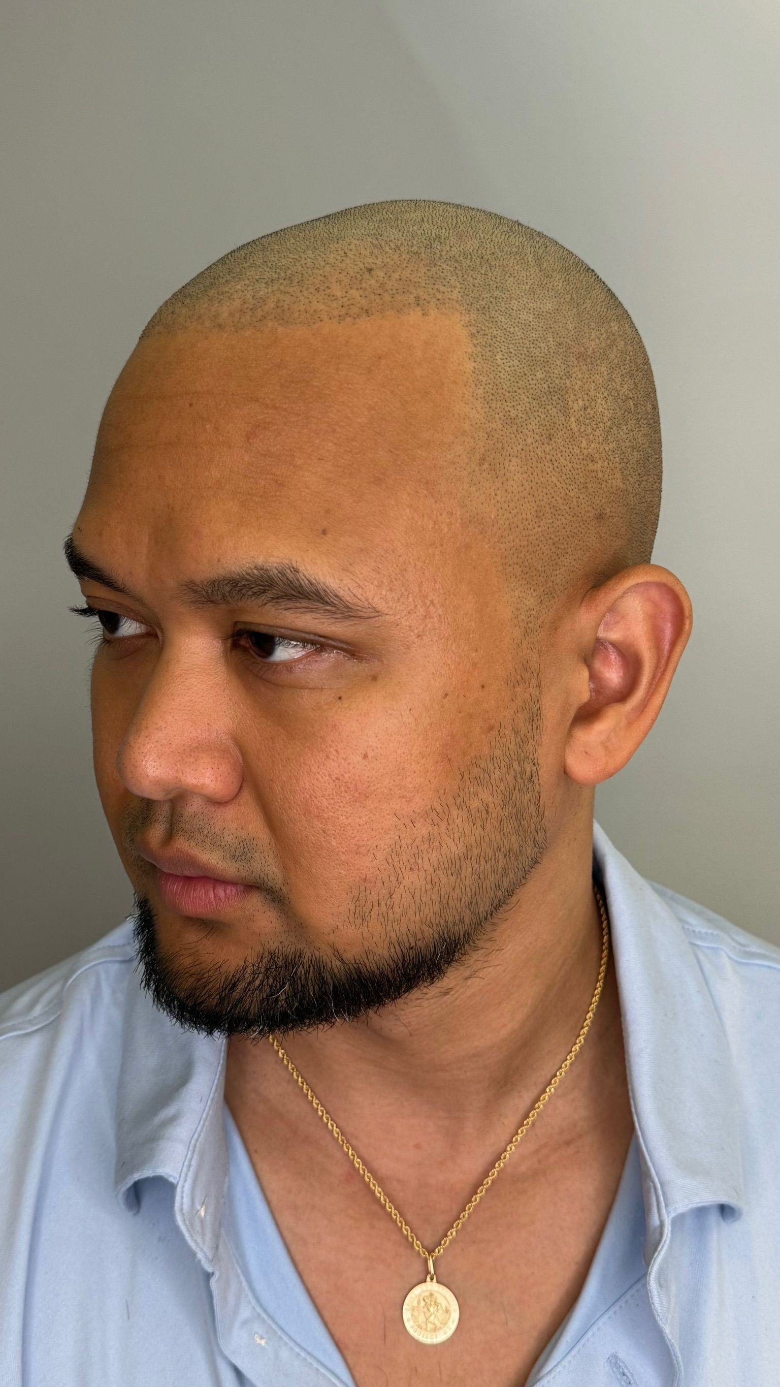 A man with a beard and a bald head is wearing a necklace.