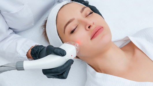 Woman receiving facial laser treatment; medical professional holding device, close-up.
