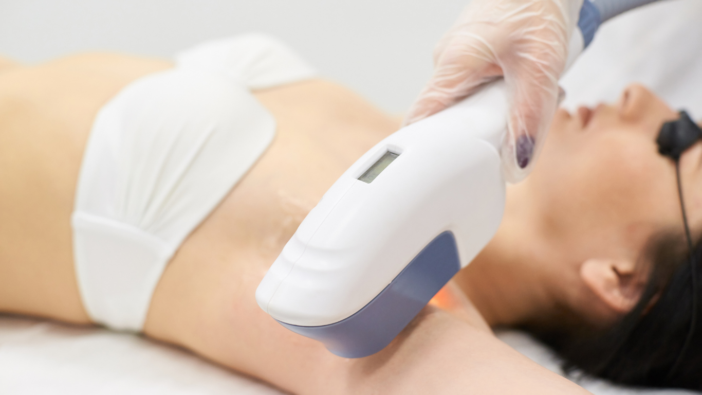 Laser hair removal on a woman's underarm, wearing a white top and protective eyewear.