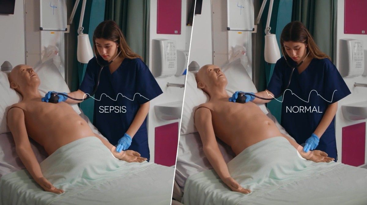 CaRE sepsis