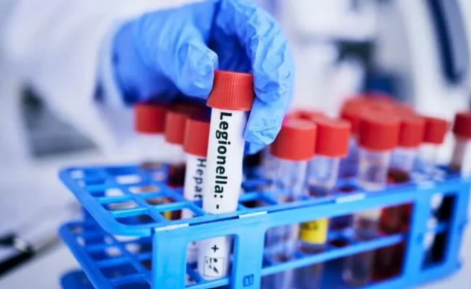 A person is holding a test tube with a label that says legionella.