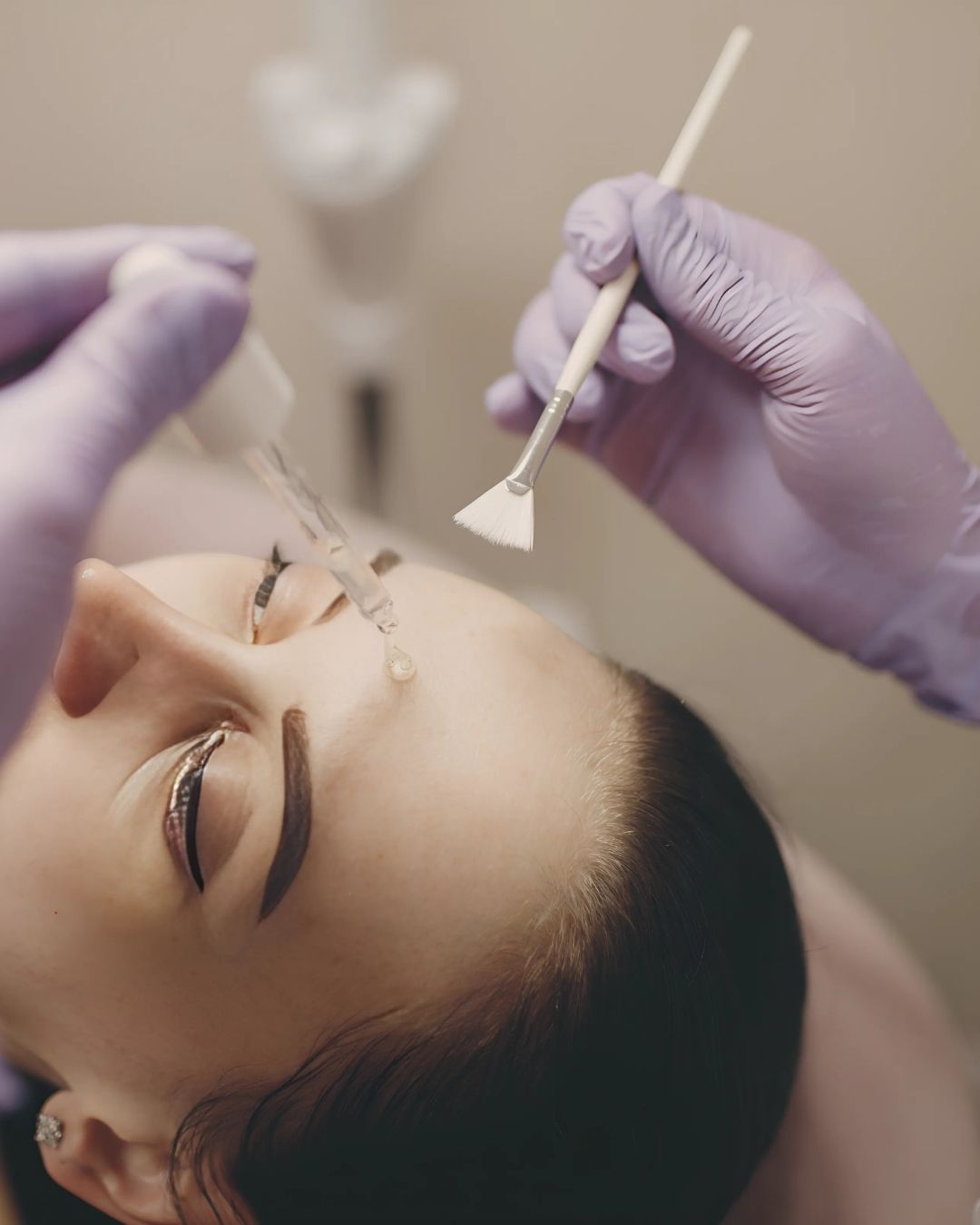 Professionele fruitzuur peeling, specifiek afgestemd op jouw huidtype en huidproblemen voor optimale resultaten