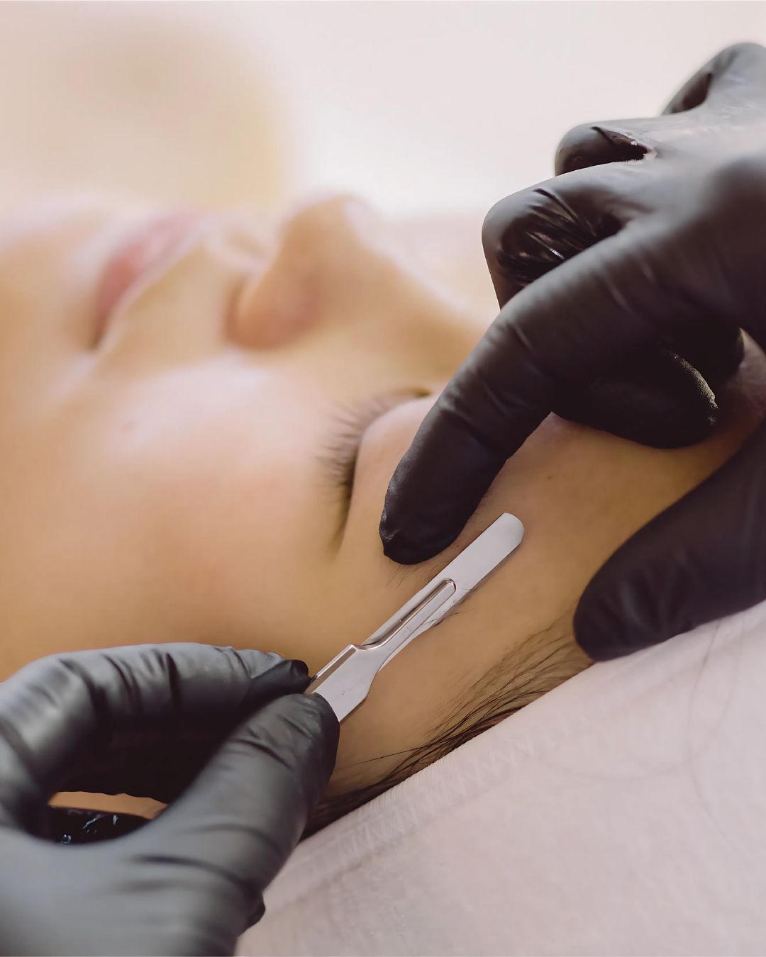 Dermaplaning bij Sev Aesthetic voor een egale, gladde huid door het verwijderen van dode huidcellen en fijne haartjes