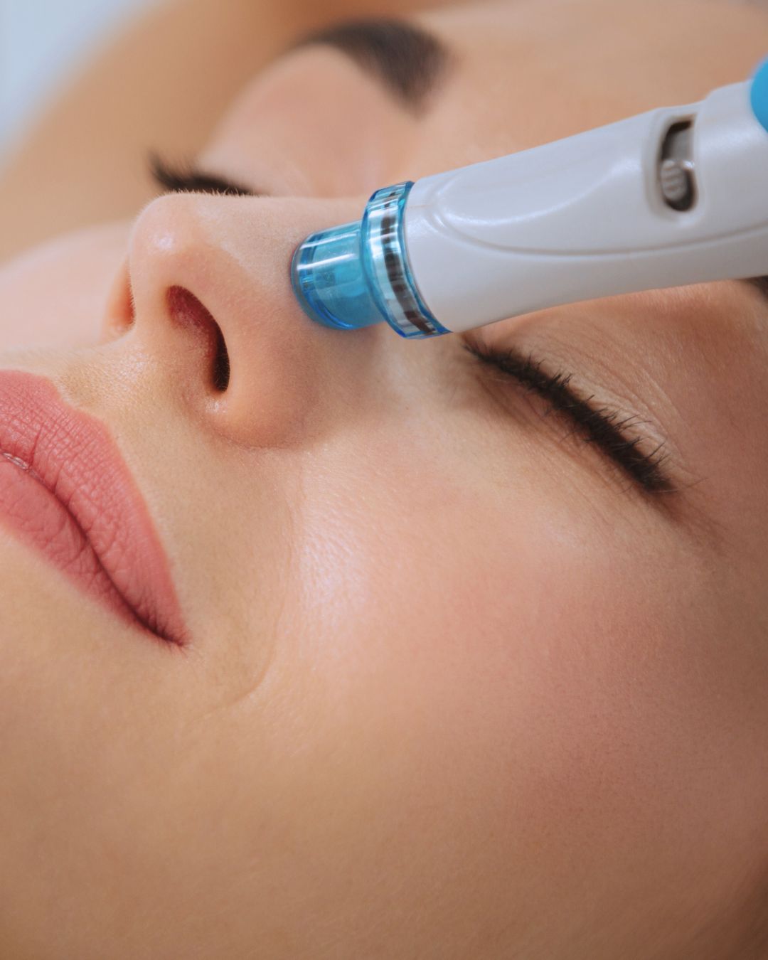 Hydra Beauty behandeling bij Sev Aesthetic voor een diepe reiniging en hydratatie van de huid, ideaal voor een frisse en stralende teint en een mooie glow