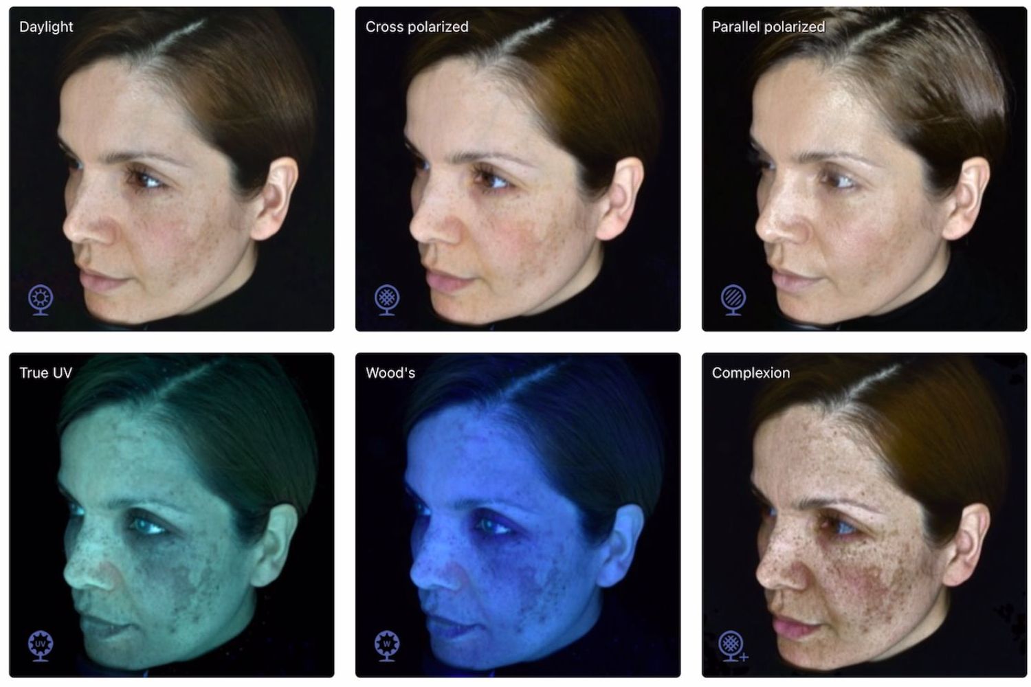 Wrinkless Clinic Patient picture on Observ scan