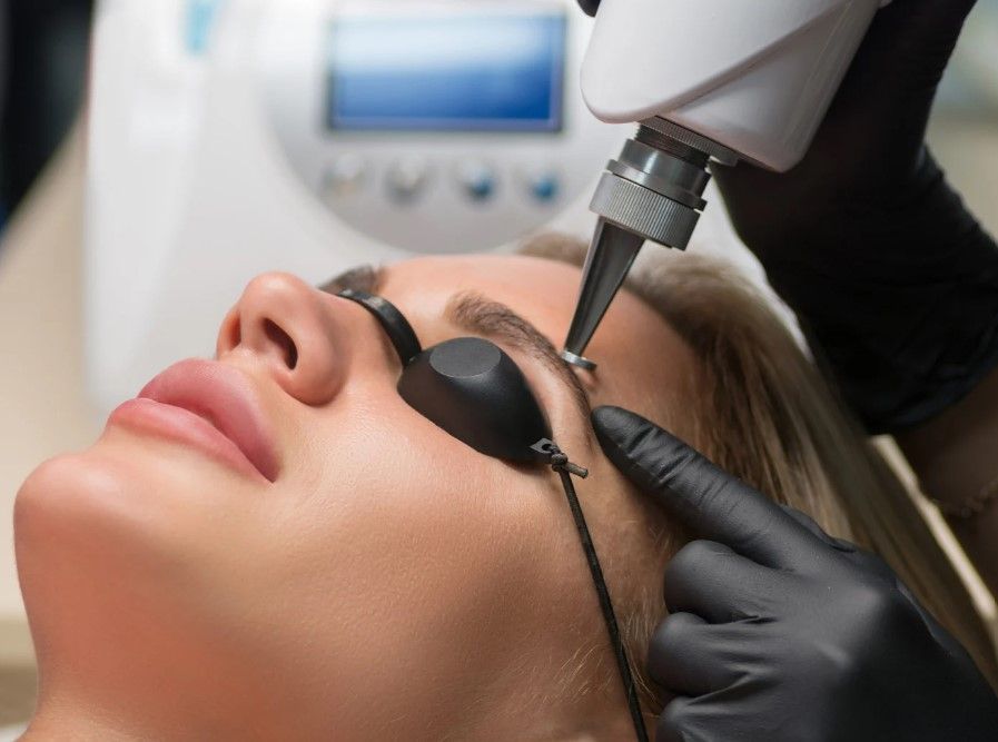 The Tattoo Removal Clinic carrying out laser eyebrow tattoo removal in the Coventry clinic