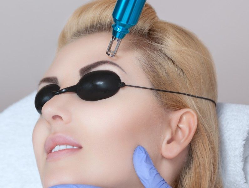 The tattoo clinic performinc eyebrow tattoo removal