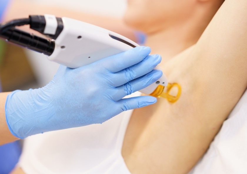 The Tattoo Removal Clinic laser hair removal from under arms