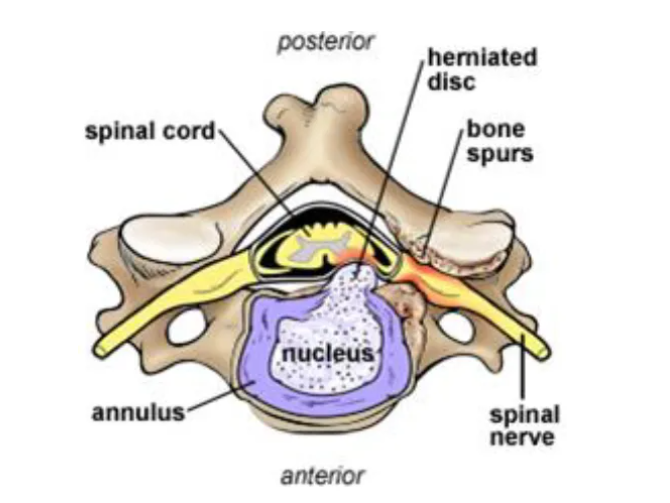 Top view of vertebra