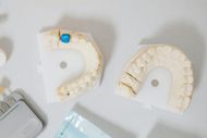 Dental models of teeth on a white surface, with a blue accent on one.