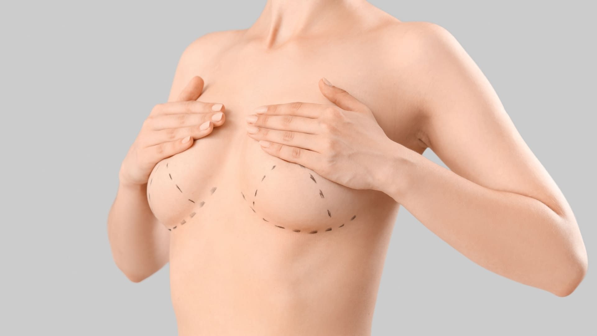 Breast Augmentation.