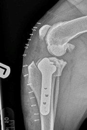 TPLO Masterclass using locking plates