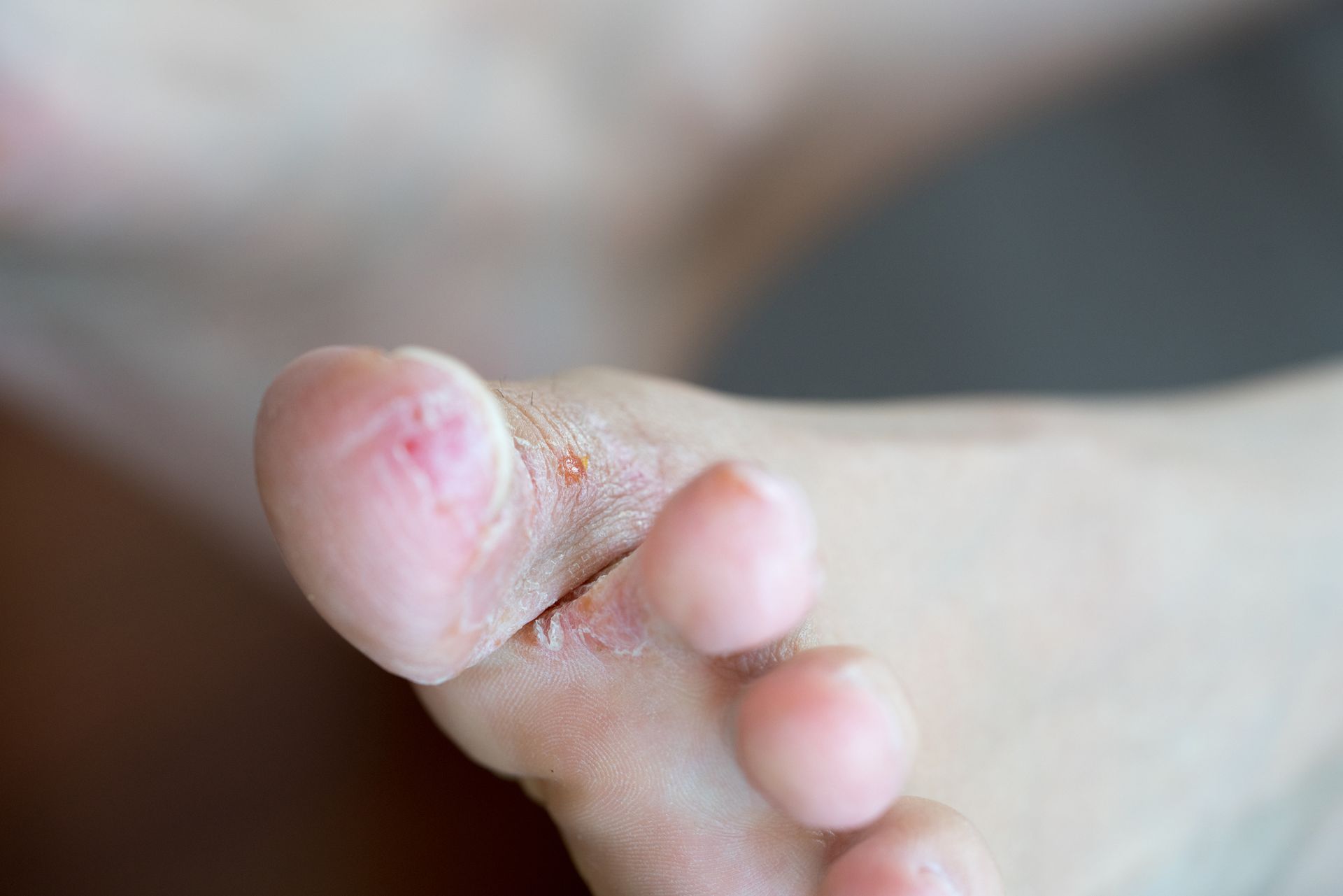 Athlete's Foot | Bel Air, MD | Foot Center Of Bel Air