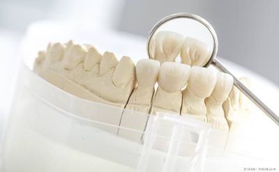 Ästhetische Gestaltung von Kronen aus reiner Keramik Ästhetische Gestaltung von Kronen aus reiner Keramik