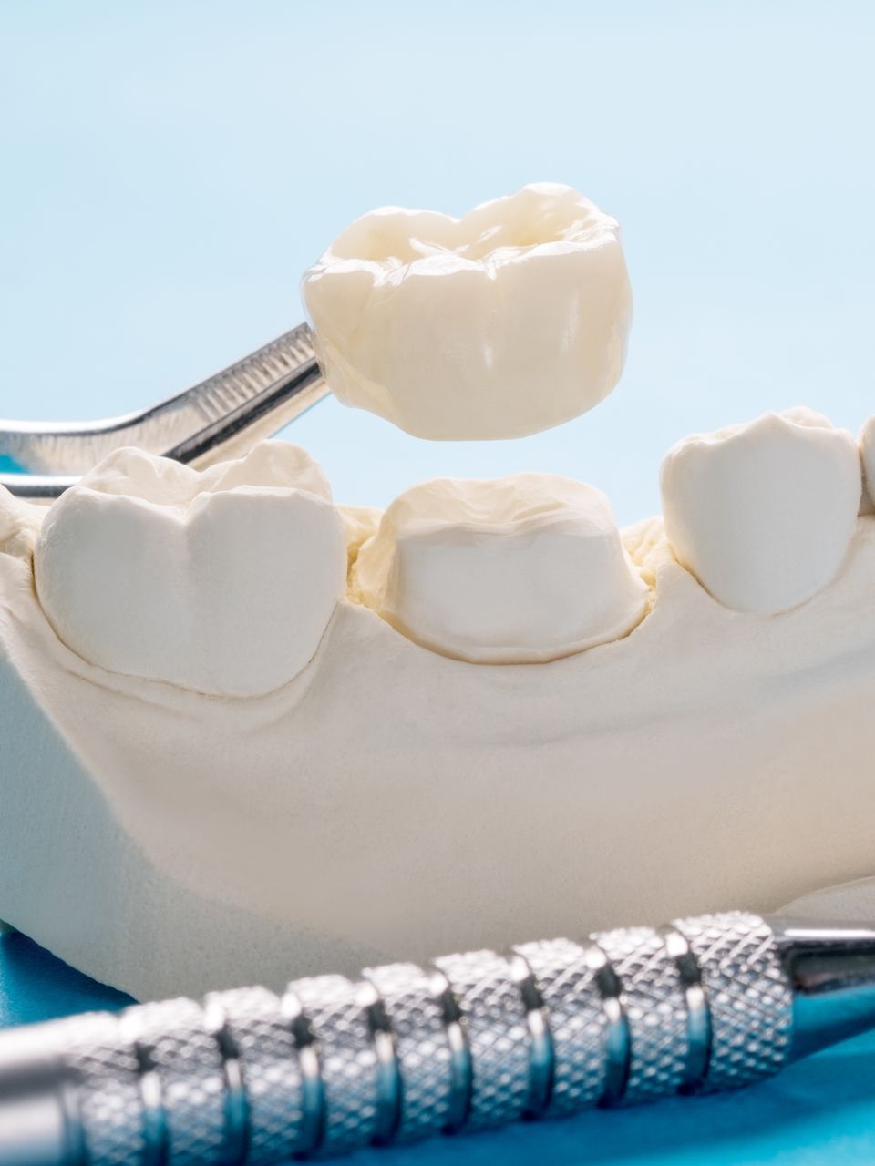 dental crown to restore your smile