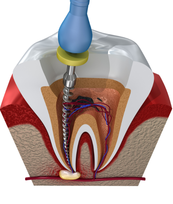 Patient taking a dental exam