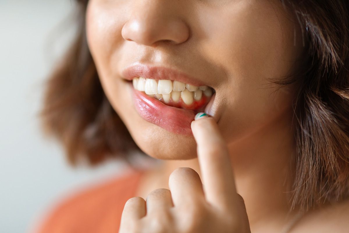 Patient taking a dental exam