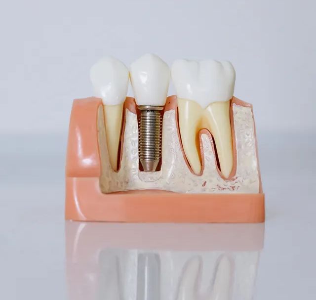 Patient taking a dental exam
