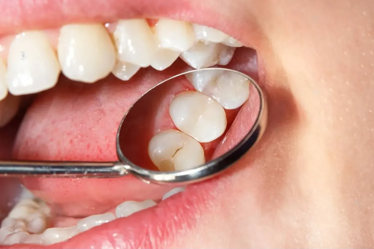 Patient taking a dental exam