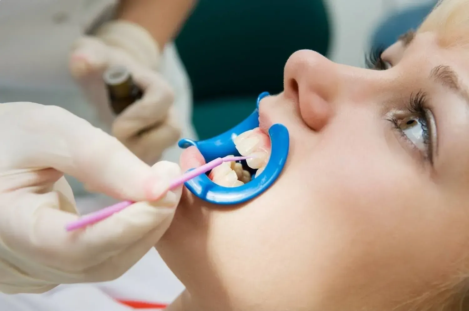 A woman is getting her teeth examined by a dentist.