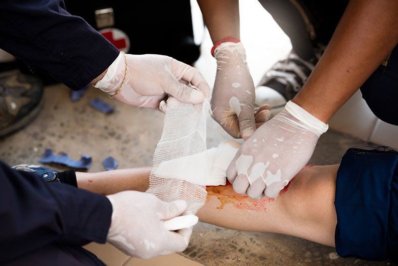 First Aid Training Leg Injury — Safe Industries Group Lake Macquarie NSW
