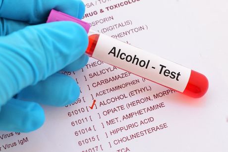 Onsite Drug And Alcohol Testing — Safe Industries Group Lake Macquarie NSW