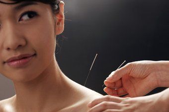 medicine and acupuncture