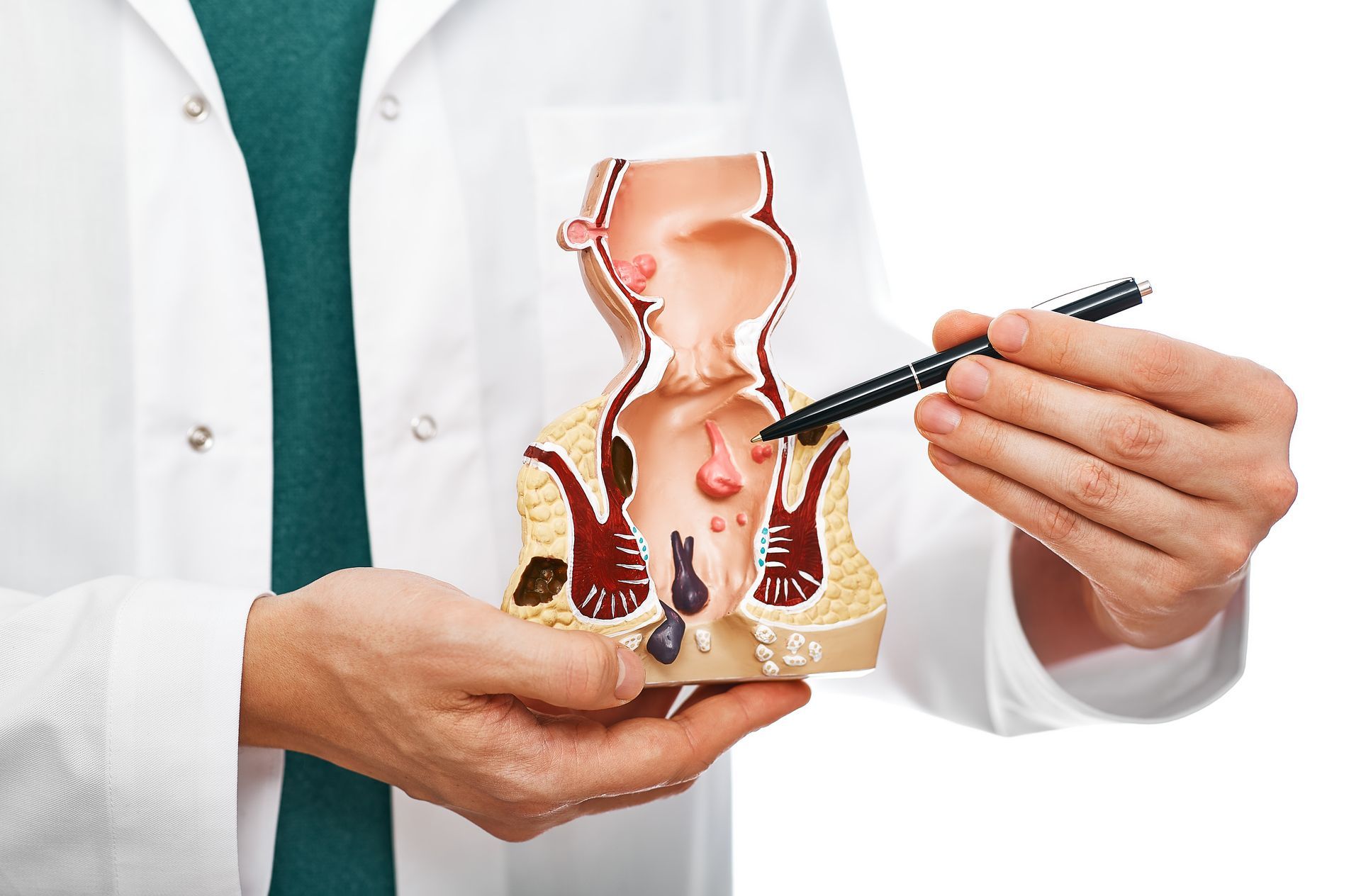 Hemorrhoid Treatment | Newburgh, IN | Evansville Colorectal