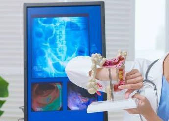 Colonoscopy | Newburgh, IN | Evansville Colorectal