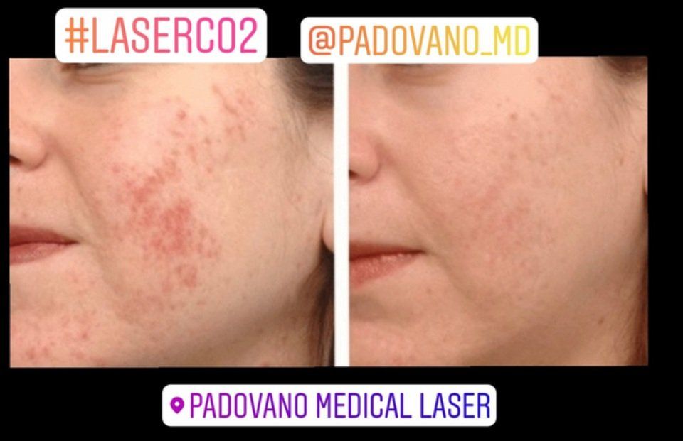 Intervento contro invecchiamento cutaneo