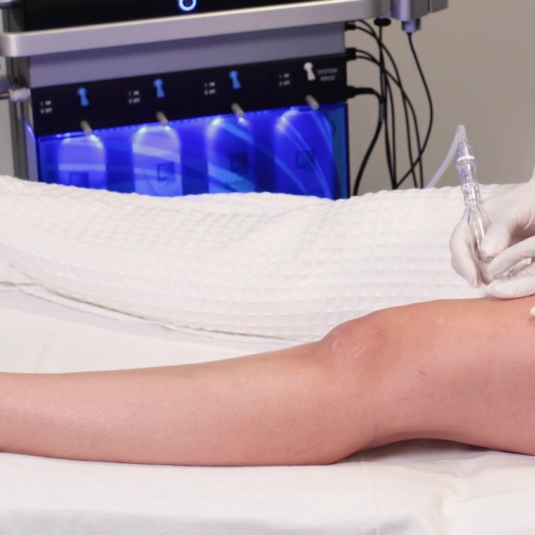 Eine Frau, die auf einem Bett liegt und eine Spritze in den Arm bekommt