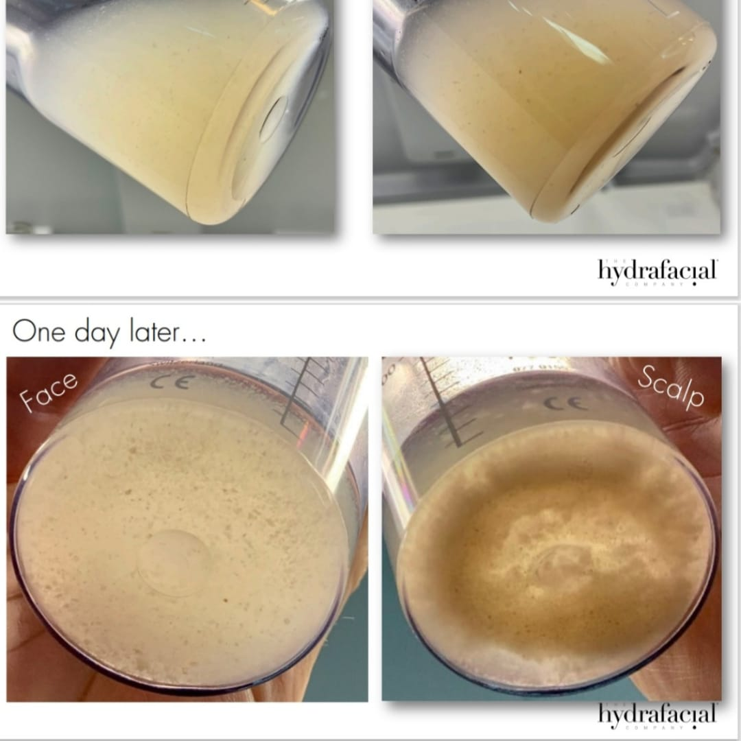 Eine Person hält einen Messbecher mit der Aufschrift „einen Tag später“