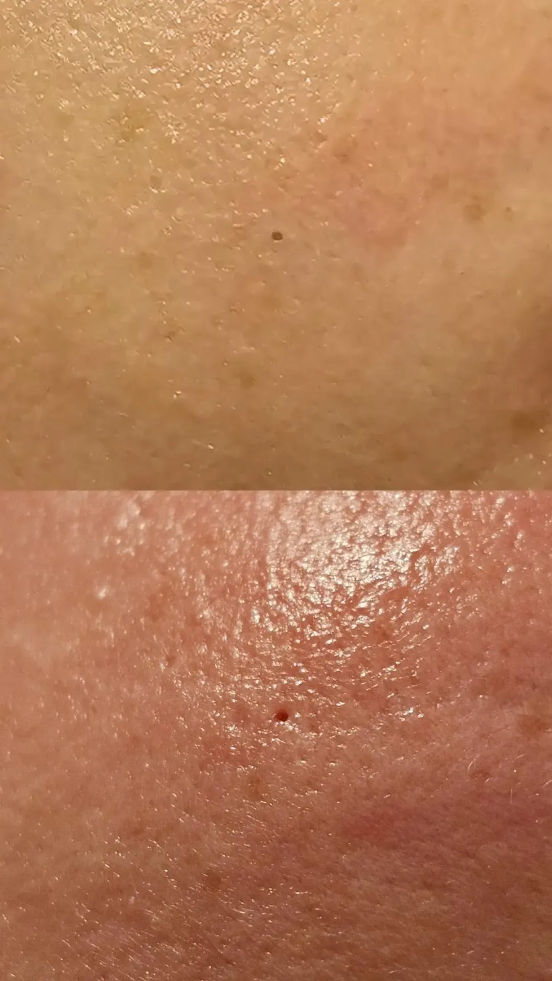 Nahaufnahme der Haut, oberer Bereich heller, unterer Bereich rötlich. 