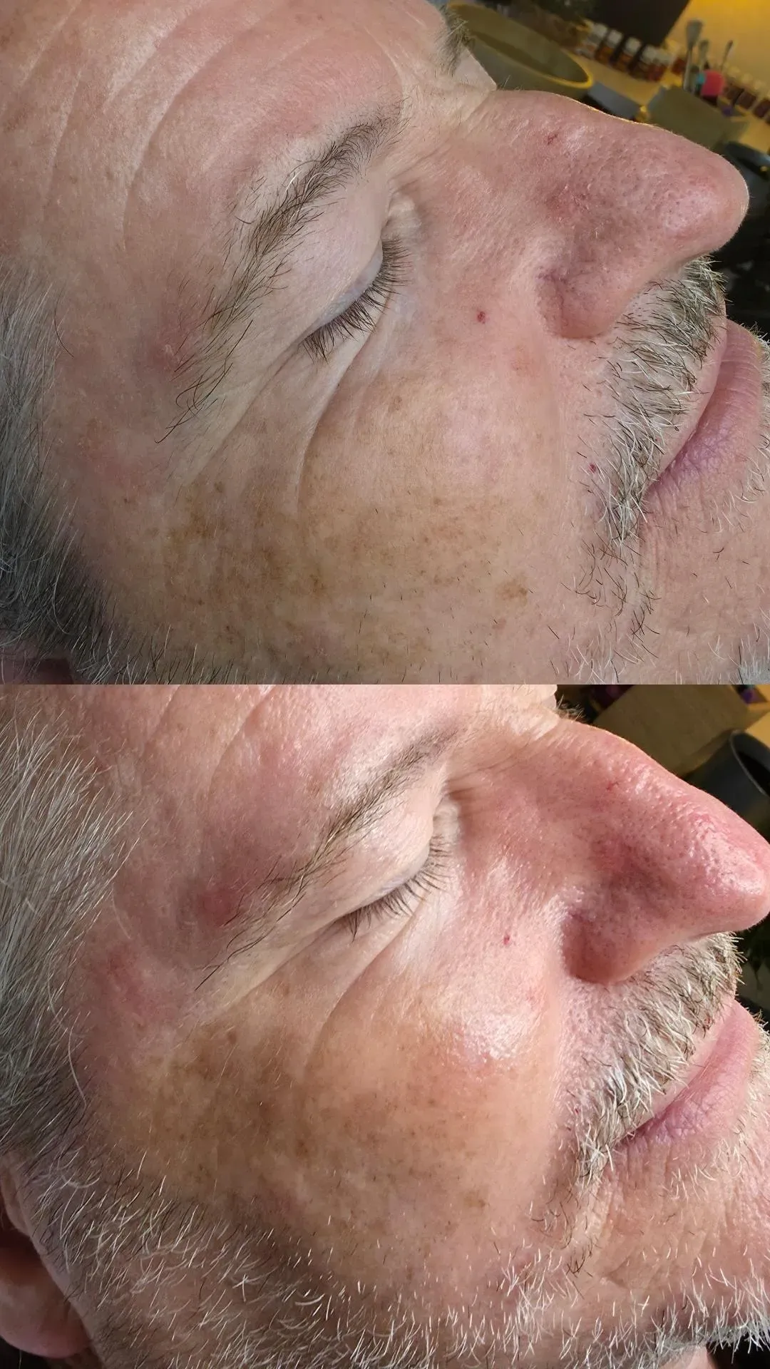 Zwei nebeneinanderliegende Bilder eines Personengesichts. Die Person hat geschlossene Augen