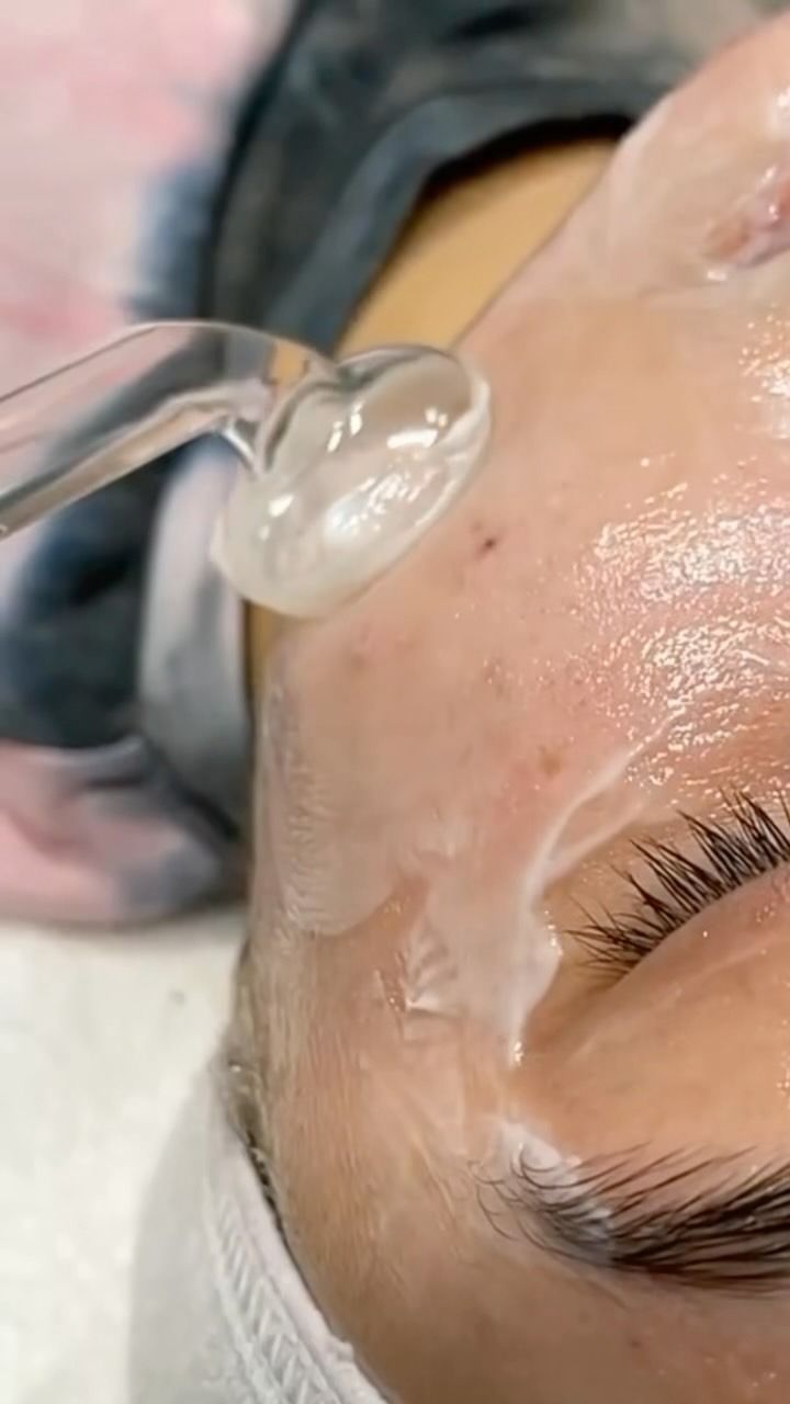 Person Undergoing a Facial Treatment With a Glass Wand on the Forehead — Sage Spa & Beauty in Mackay, QLD