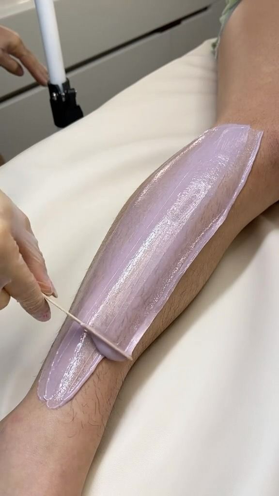 Leg Being Waxed; a Light Purple Wax Covers the Lower Leg — Sage Spa & Beauty in Mackay, QLD