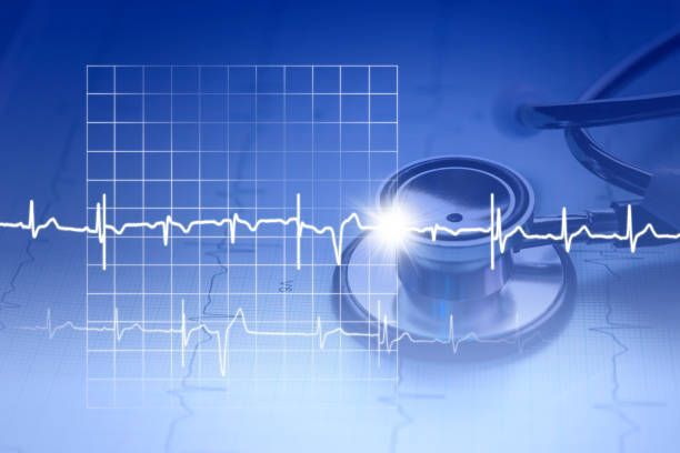 stethoscope beside heart rate chart