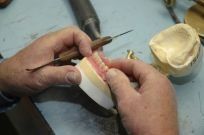 New denture being made