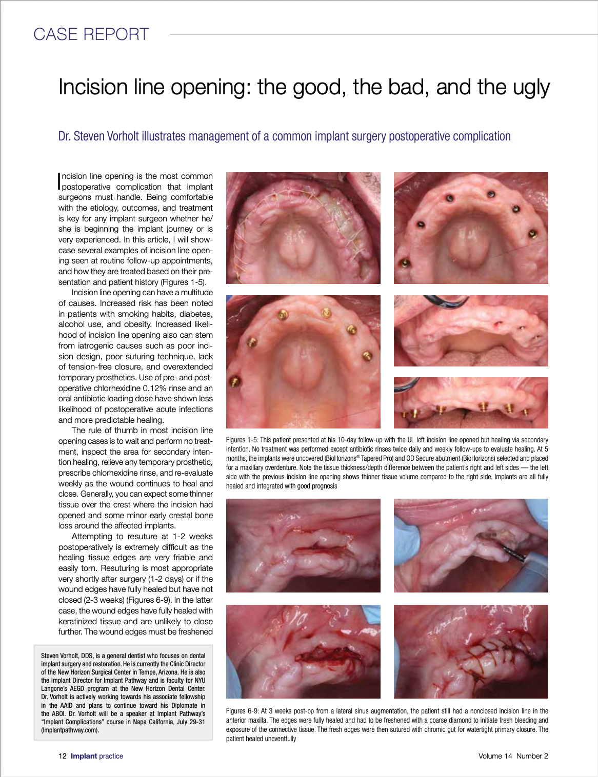 First page of article, 