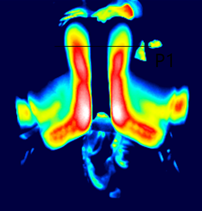 Thermografie Pferderücken