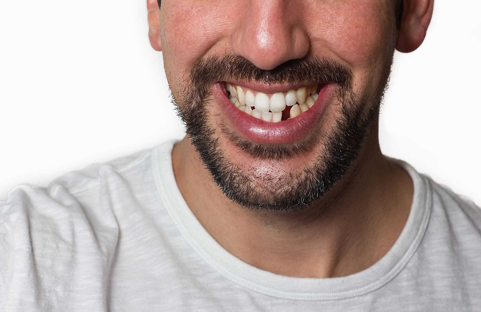 A man with a beard and missing teeth is smiling.